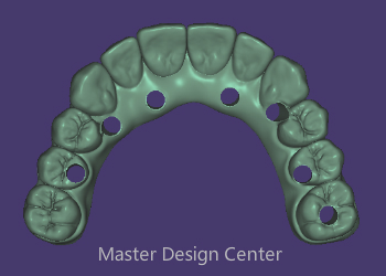 Full Arch Implant Bridge