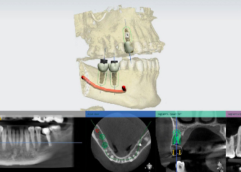 Surgery Guide