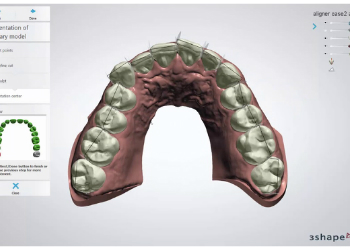 Clear Aligner Design