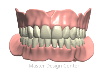Denture Design
