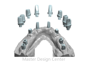 Abutment Design