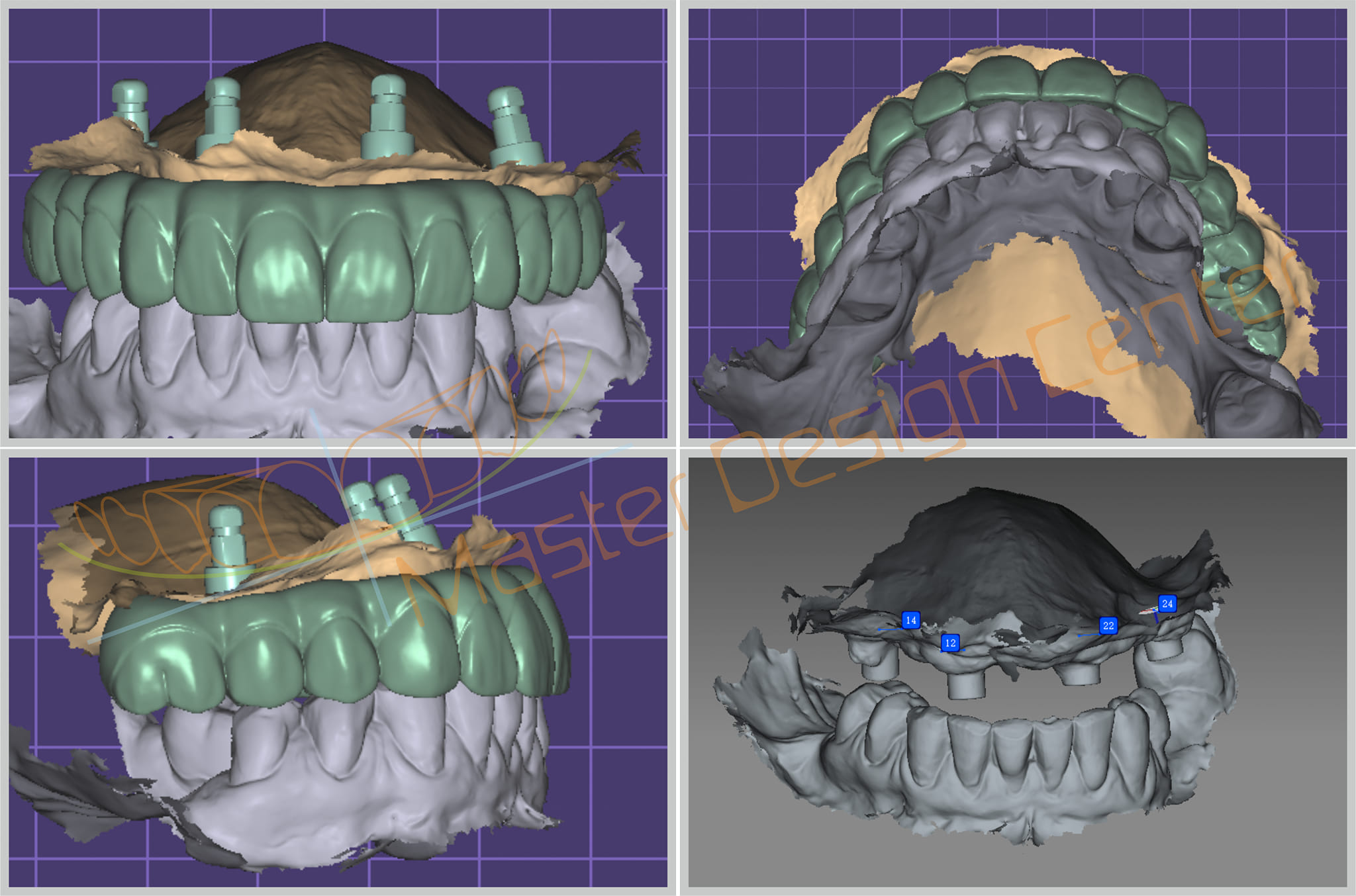 All on X + Icam4d Design