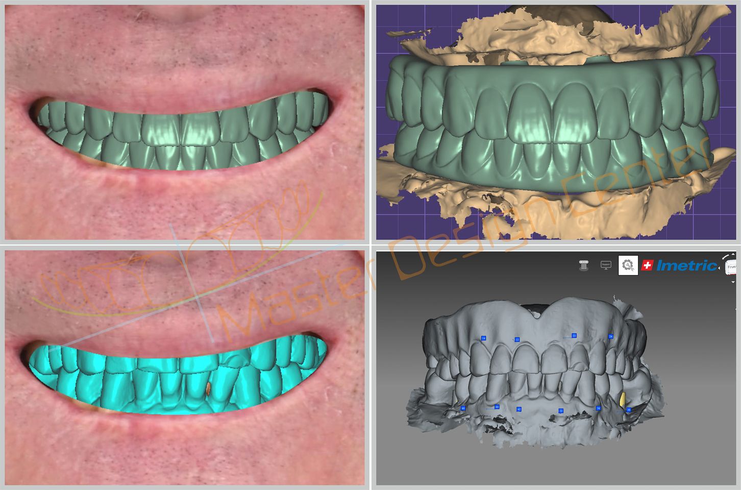 All on 4/6 + Icam4d Design